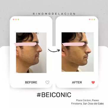 Slider image (4) ICONIC Medical Aesthetic